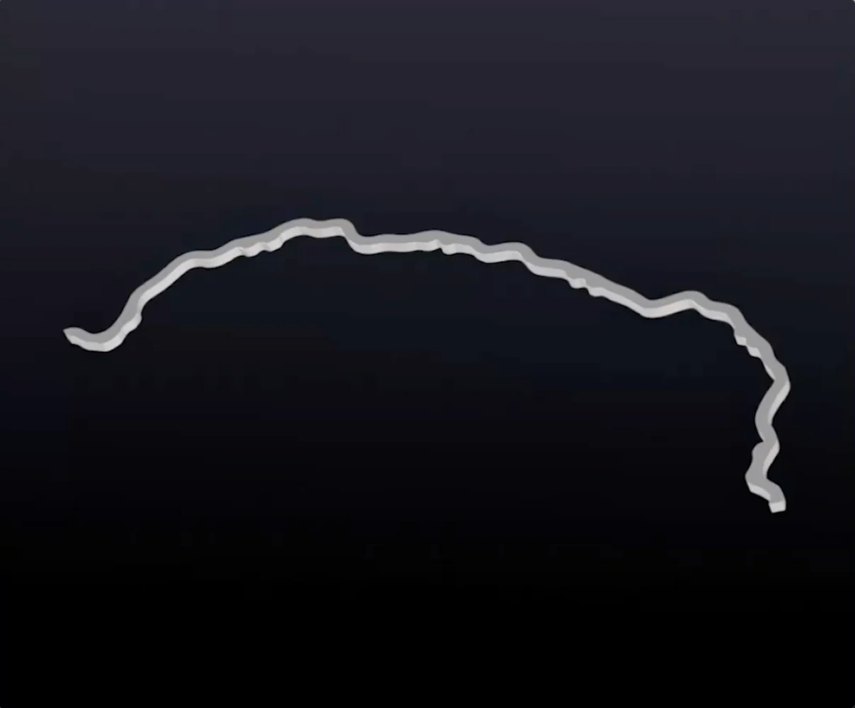 Festsitzende Retainer